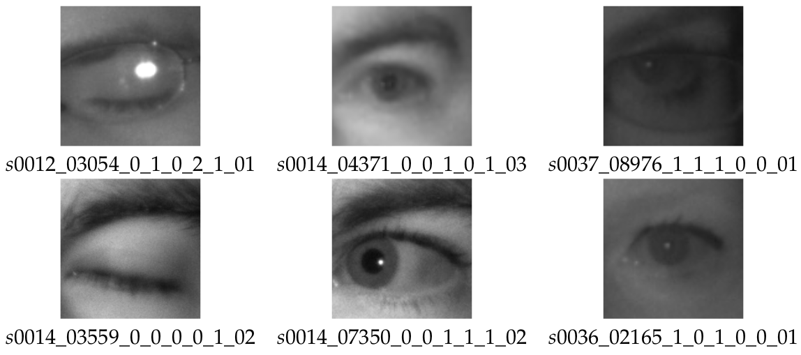 eye-dataset-kaggle